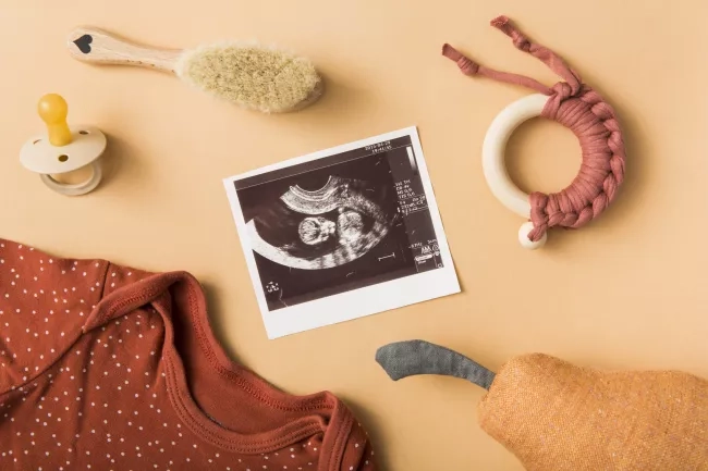 flatlay of ultrasound scan 