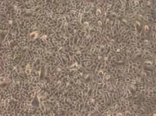 Cord Lining Epithelial Stem Cells (CLEpSCs)