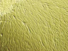 Mesenchymal Stem Cells (MSCs)